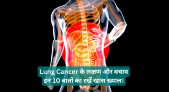 Lung Cancer के लक्षण और बचाव – इन 10 बातों का रखें खास ख्याल।